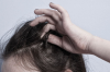 Những điều bạn cần biết về hội chứng nghiện giật tóc