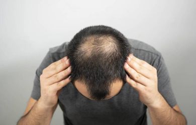 Tóc bị rụng từng mảng thì phải làm để khỏi?