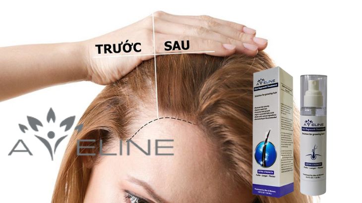 Serum hỗ trợ mọc tóc Aveline
