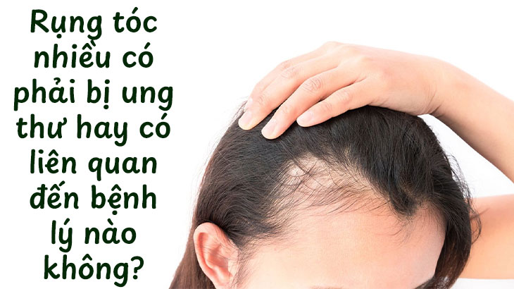 Rụng tóc nhiều có phải bị ung thư hay có liên quan đến bệnh lý nào không?